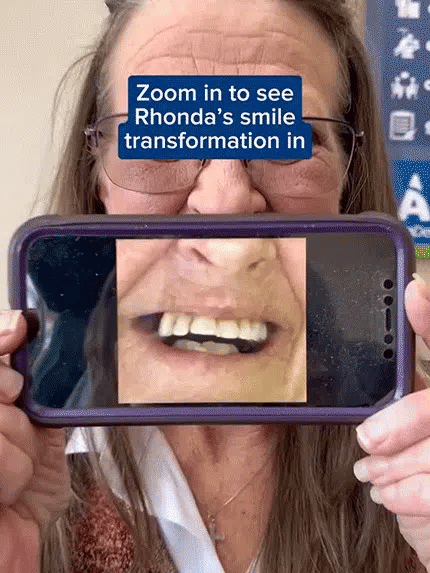 ✨Premium Upgrade Full‑Cover Cosmetic Dentures🦷 One‑Click Perfect Smile Veneers for All Adults