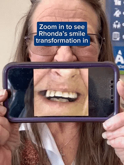 ✨Premium Upgrade Full‑Cover Cosmetic Dentures🦷 One‑Click Perfect Smile Veneers for All Adults