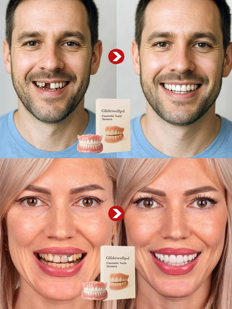 🦷[Epic Upgrade] Premium Full Cover Dentures🦷
