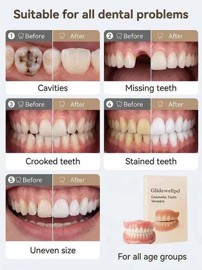 🦷[Epic Upgrade] Premium Full Cover Dentures🦷