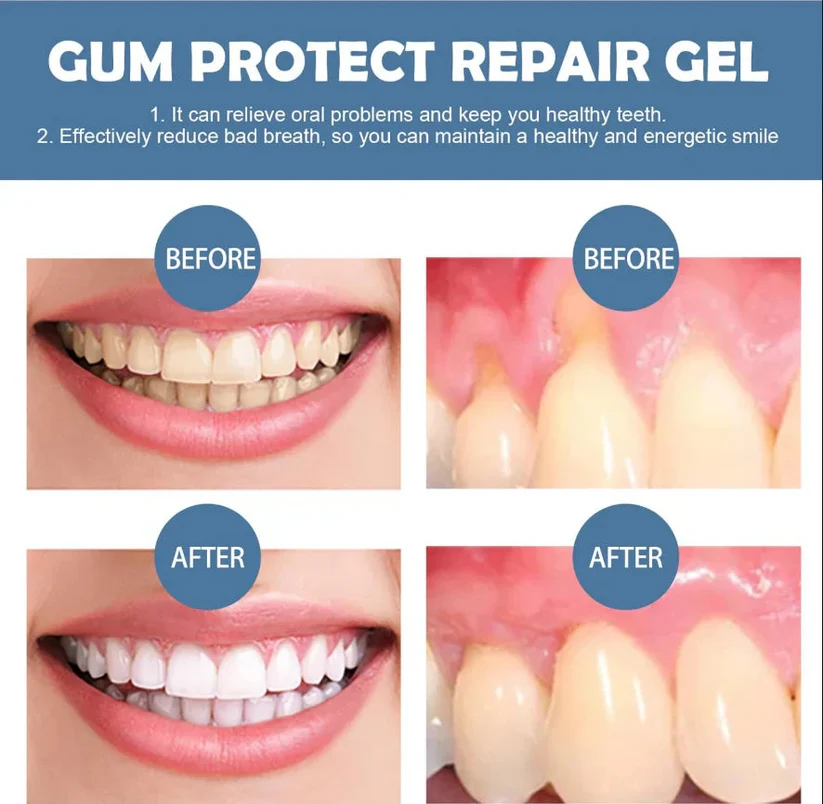 Zyverin™ Teeth Repair Gel