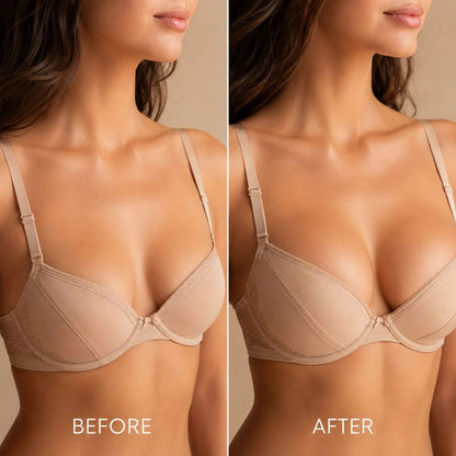 ✨ Breast Enhance Mentmicroneedle Patch