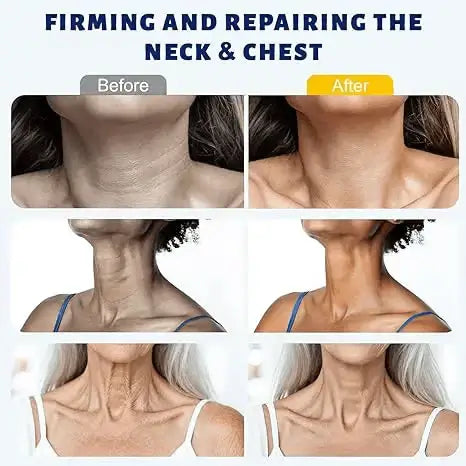 💡Fades dark spots & reduces skin dullness - LOVILDS™ Instant Neck Lift Cream