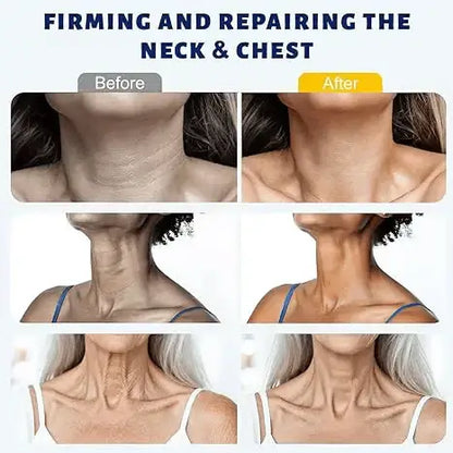 💡Fades dark spots & reduces skin dullness - LOVILDS™ Instant Neck Lift Cream