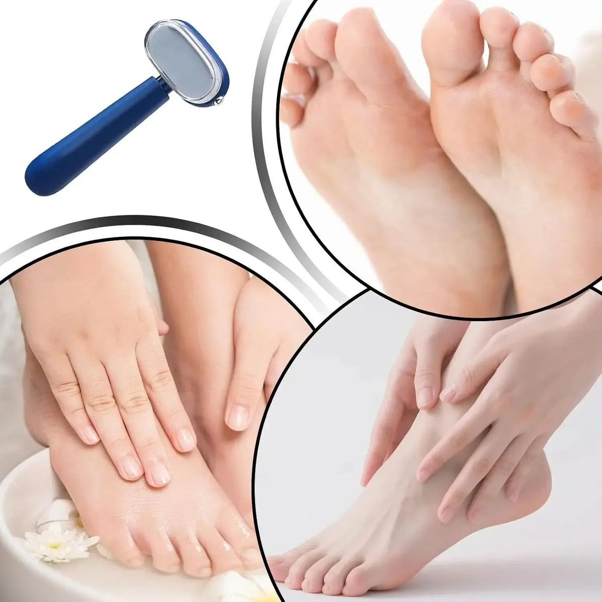 Hot Sale 🦶 Dual-Sided Foot Callus Remover – Smooth, Soft Feet Without the Fuss