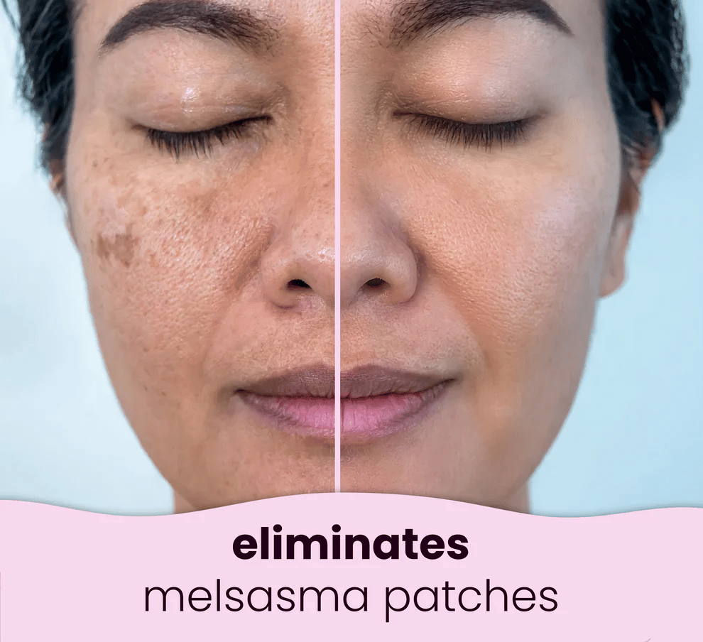 🍋	 Last Day Buy 1 Get 1 Free🔥Turmeric Kojic Acid Cleansing Pads🍋